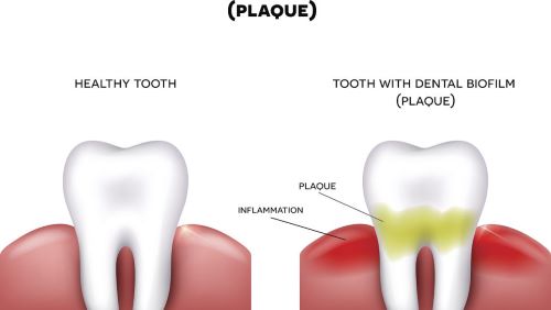 牙科材料如何申請俄羅斯醫療器械注冊證 牙科材料如何申請俄羅斯醫療器械注冊證